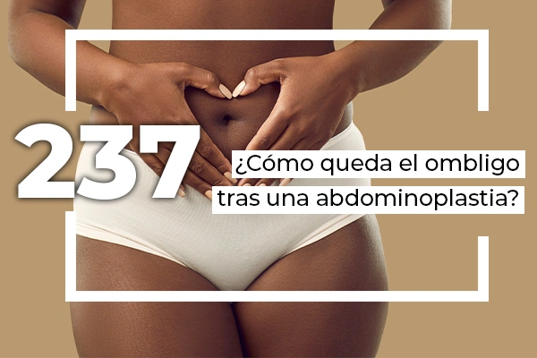 ombligo despues de una abdominoplastia