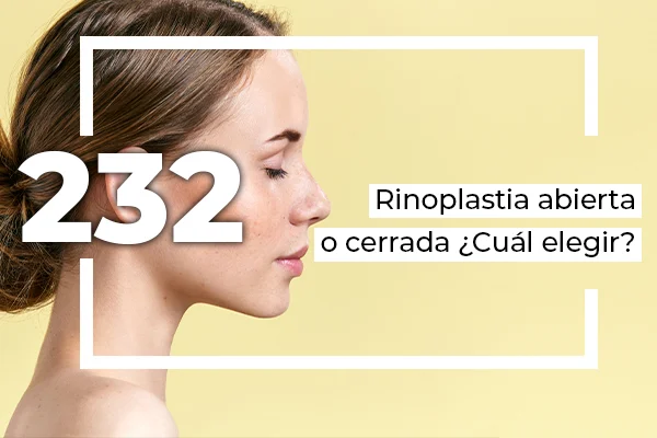 rinoplastia abierta o cerrada