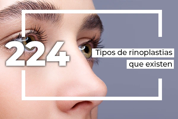 tipos de rinoplastia