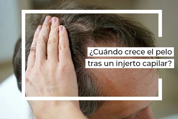 injerto capilar pelo crece
