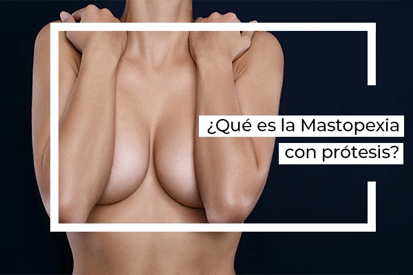 mastopexia con prótesis