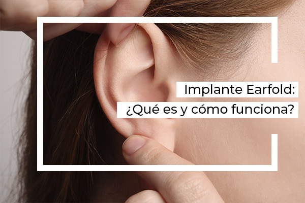 implante earfold en oreja blog