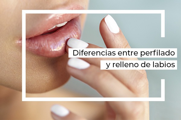 perfilado de labios con acidgo hialuronico